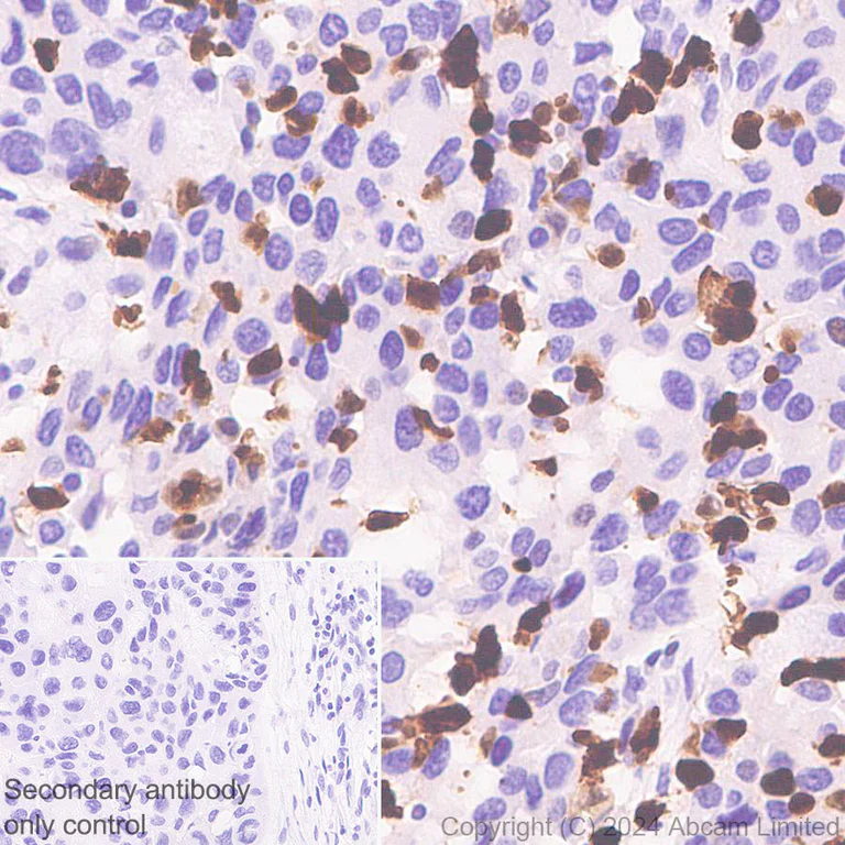 Immunohistochemistry (Formalin/PFA-fixed paraffin-embedded sections) - Anti-Hexokinase Type III/HK3 antibody [EPR29196-29] - BSA and Azide free (AB321997)