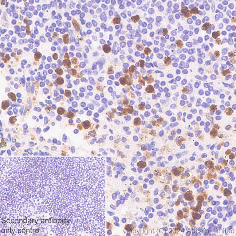 Immunohistochemistry (Formalin/PFA-fixed paraffin-embedded sections) - Anti-Hexokinase Type III/HK3 antibody [EPR29196-29] - BSA and Azide free (AB321997)