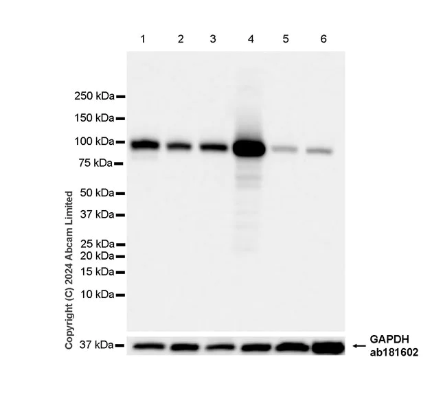 Western blot - Anti-Hexokinase Type III/HK3 antibody [EPR29196-29] - BSA and Azide free (AB321997)