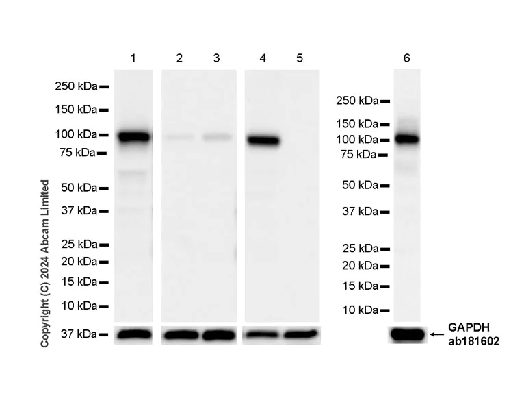 Western blot - Anti-Hexokinase Type III/HK3 antibody [EPR29196-29] - BSA and Azide free (AB321997)