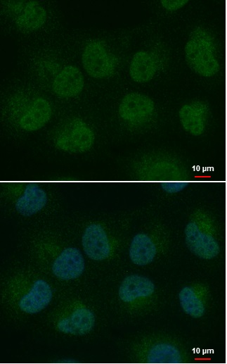 Immunocytochemistry/ Immunofluorescence - Anti-HEY1 antibody (AB154077), expandable thumbnail