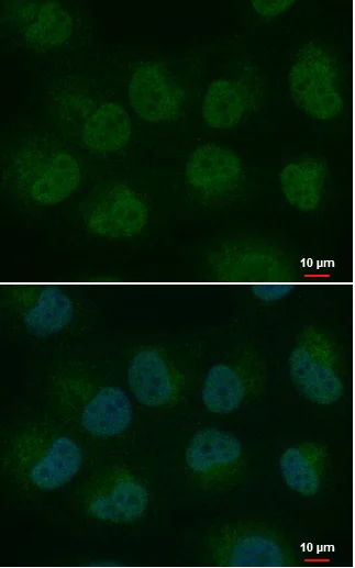 Immunocytochemistry/ Immunofluorescence - Anti-HEY1 antibody (AB154077)