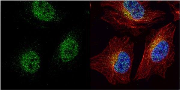 Immunocytochemistry/ Immunofluorescence - Anti-HEY1 antibody (AB154077), expandable thumbnail