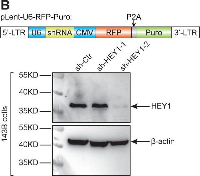 Western blot - Anti-HEY1 antibody (AB154077), expandable thumbnail