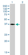 Western blot - Anti-HEY2 antibody (AB167280)