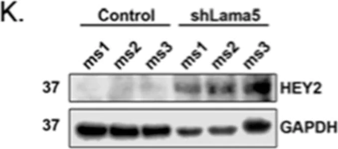 Western blot - Anti-HEY2 antibody (AB167280)
