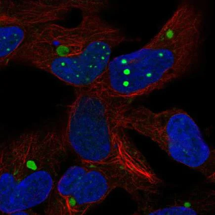 Immunocytochemistry/ Immunofluorescence - Anti-HEY2 antibody (AB221931)