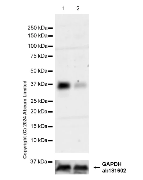 Western blot - Anti-HEY2 antibody [EPR29024-13] (AB323267)