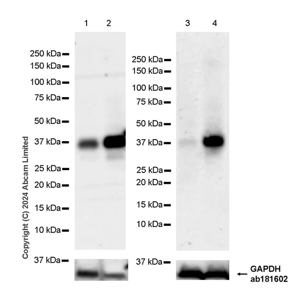 Western blot - Anti-HEY2 antibody [EPR29024-13] (AB323267)