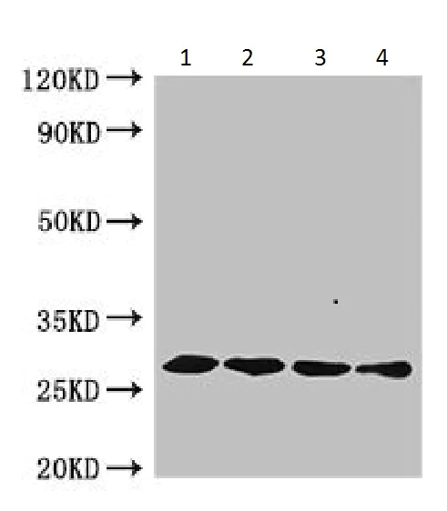 Western blot - Anti-HFBI antibody (AB225992)