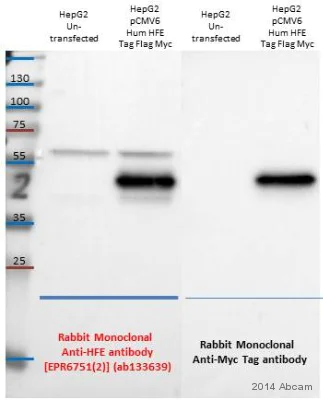 Western blot - Anti-HFE antibody [EPR6751(2)] (AB133639)