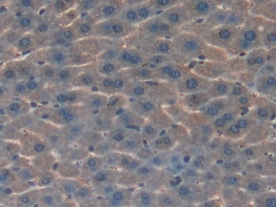 Immunohistochemistry (Formalin/PFA-fixed paraffin-embedded sections) - Anti-HGD antibody (AB231968)