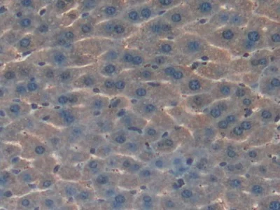 Immunohistochemistry (Formalin/PFA-fixed paraffin-embedded sections) - Anti-HGD antibody (AB231968)