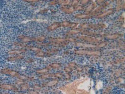 Immunohistochemistry (Formalin/PFA-fixed paraffin-embedded sections) - Anti-HGD antibody (AB231968)