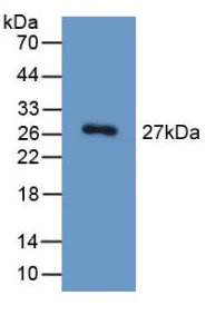 Western blot - Anti-HGD antibody (AB231968)