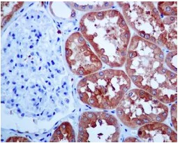 Immunohistochemistry (Formalin/PFA-fixed paraffin-embedded sections) - Anti-HGD antibody [EPR7874] (AB131035)