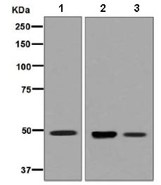 Western blot - Anti-HGD antibody [EPR7874] (AB131035), expandable thumbnail