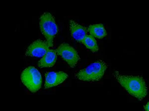 Immunocytochemistry/ Immunofluorescence - Anti-HGD antibody [EPR7874] - BSA and Azide free (AB248354)