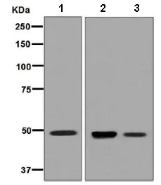 Western blot - Anti-HGD antibody [EPR7874] - BSA and Azide free (AB248354)