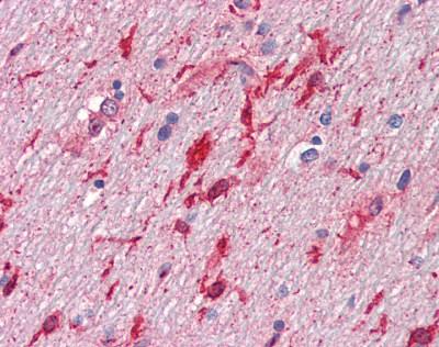 Immunohistochemistry (Formalin/PFA-fixed paraffin-embedded sections) - Anti-HGF antibody [7-2] (AB118871), expandable thumbnail