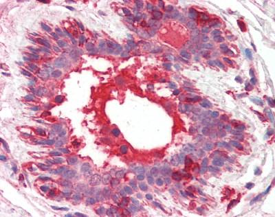 Immunohistochemistry (Formalin/PFA-fixed paraffin-embedded sections) - Anti-HGF antibody [7-2] (AB118871), expandable thumbnail