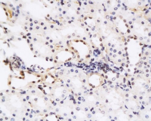 Immunohistochemistry (Formalin/PFA-fixed paraffin-embedded sections) - Anti-HGF antibody (AB216623)