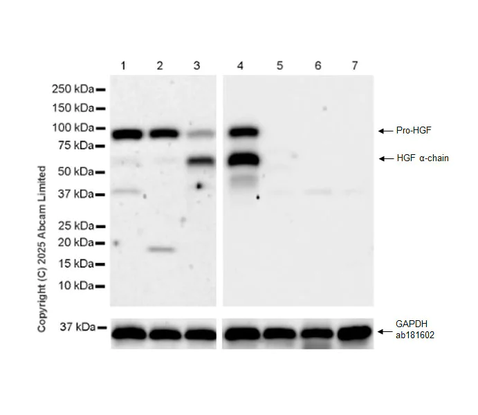 Western blot - Anti-HGF antibody [EPR27305-38] (AB323375)