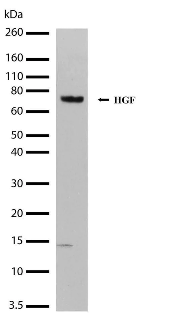 Western blot - Anti-HGF Antibody [RP23040069] (AB313408)