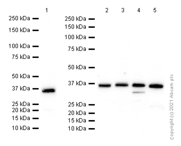 Western blot - Anti-HGFA Inhibitor 2 antibody [EPR6283(2)] (AB128926)