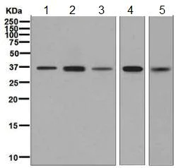 Western blot - Anti-HGFA Inhibitor 2 antibody [EPR6283(2)] - BSA and Azide free (AB248225)