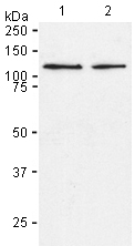 Western blot - Anti-HGS antibody [19-5] (AB150653), expandable thumbnail