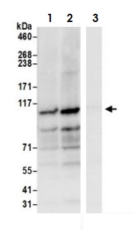 Immunoprecipitation - Anti-HGS antibody (AB72053)