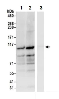 Immunoprecipitation - Anti-HGS antibody (AB72053)