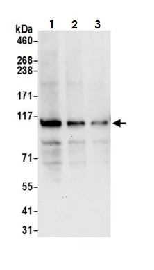 Western blot - Anti-HGS antibody (AB72053)