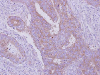 Immunohistochemistry (Formalin/PFA-fixed paraffin-embedded sections) - Anti-HGS antibody - C-terminal (AB155539), expandable thumbnail