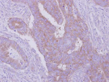 Immunohistochemistry (Formalin/PFA-fixed paraffin-embedded sections) - Anti-HGS antibody - C-terminal (AB155539)