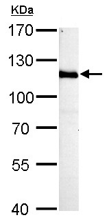 Western blot - Anti-HGS antibody - C-terminal (AB155539), expandable thumbnail