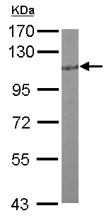 Western blot - Anti-HGS antibody - C-terminal (AB155539), expandable thumbnail