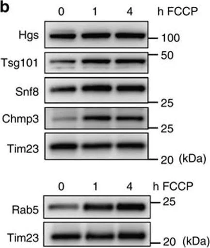 Western blot - Anti-HGS antibody - C-terminal (AB155539)
