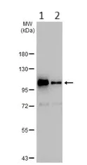 Western blot - Anti-HGS antibody - C-terminal (AB155539)