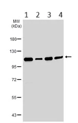Western blot - Anti-HGS antibody - C-terminal (AB155539)