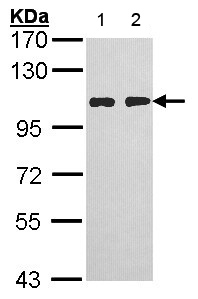 Western blot - Anti-HGS antibody - C-terminal (AB155539), expandable thumbnail
