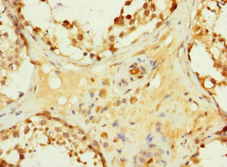 Immunohistochemistry (Formalin/PFA-fixed paraffin-embedded sections) - Anti-Hhip antibody (AB230271)