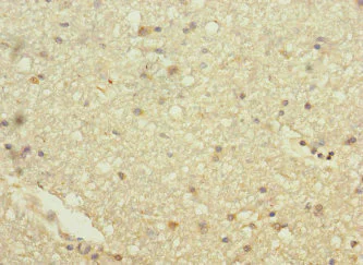 Immunohistochemistry (Formalin/PFA-fixed paraffin-embedded sections) - Anti-Hhip antibody (AB230271)