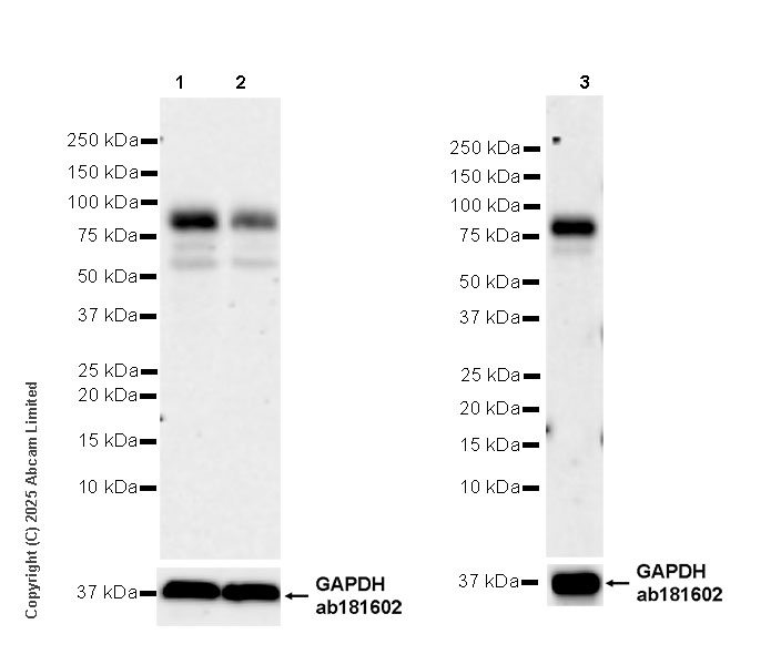 Western blot - Anti-Hhip antibody [EPR29660-579] (AB324310), expandable thumbnail