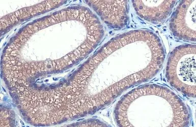 Immunohistochemistry paraffin embedded sections - Anti-HHIP antibody [HL1737] (AB308574)