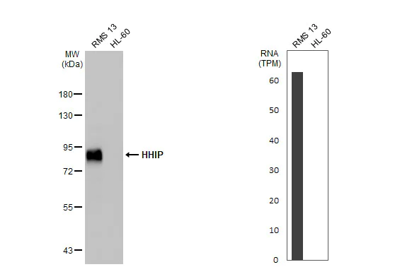 Western blot - Anti-HHIP antibody [HL1737] (AB308574)