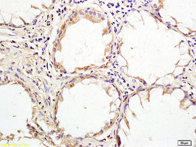 Immunohistochemistry (Formalin/PFA-fixed paraffin-embedded sections) - Anti-HHLA2 antibody (AB214327)