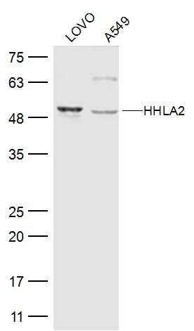 Western blot - Anti-HHLA2 antibody (AB214327)