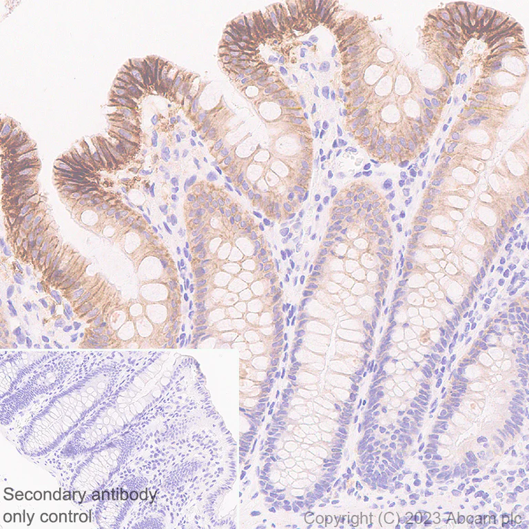 Immunohistochemistry (Formalin/PFA-fixed paraffin-embedded sections) - Anti-HHLA2 antibody [EPR26395-88] - BSA and Azide free (AB315995)